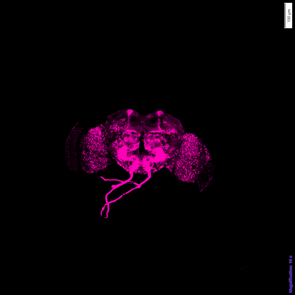 Whole-brain immunostaining (magenta) showing neuronal architecture