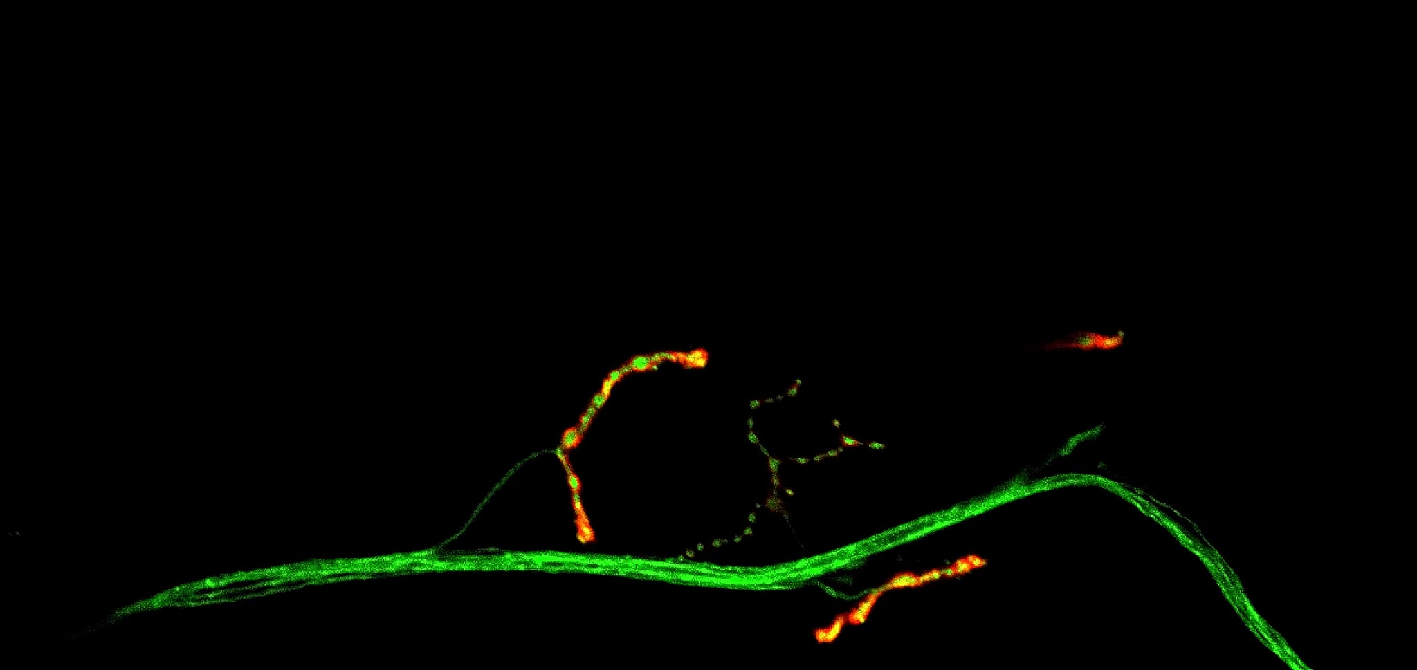 NMJ landscape — synaptic terminals along the muscle